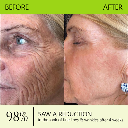 𝑶𝒇𝒇𝒊𝒄𝒊𝒂𝒍 𝑺𝒕𝒐𝒓𝒆😍| Regain youthful skin nown 💫STDEI® BOTOX & VITA A RETINOL SHOT Wrinkle Lift Tightening Cream