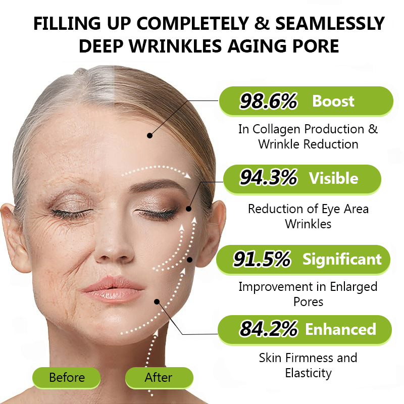 𝑶𝒇𝒇𝒊𝒄𝒊𝒂𝒍 𝑺𝒕𝒐𝒓𝒆😍| Regain youthful skin nown 💫STDEI® BOTOX & VITA A RETINOL SHOT Wrinkle Lift Tightening Cream