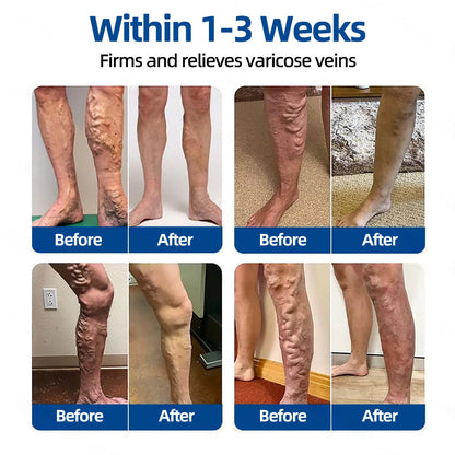 𝑶𝒇𝒇𝒊𝒄𝒊𝒂𝒍 𝑺𝒕𝒐𝒓𝒆🍀|𝐅𝐥𝐨𝐫𝐢𝐬𝐦𝐚® 𝐕𝐞𝐢𝐧𝐓𝐚𝐫𝐠𝐞𝐭 𝐌𝐢𝐜𝐫𝐨𝐧𝐞𝐞𝐝𝐥𝐞 𝐏𝐚𝐭𝐜𝐡⚡Instant Relief, Long-Term Results