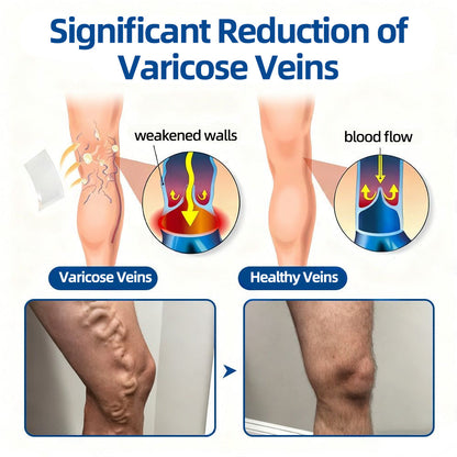𝑶𝒇𝒇𝒊𝒄𝒊𝒂𝒍 𝑺𝒕𝒐𝒓𝒆🍀|𝐅𝐥𝐨𝐫𝐢𝐬𝐦𝐚® 𝐕𝐞𝐢𝐧𝐓𝐚𝐫𝐠𝐞𝐭 𝐌𝐢𝐜𝐫𝐨𝐧𝐞𝐞𝐝𝐥𝐞 𝐏𝐚𝐭𝐜𝐡⚡Instant Relief, Long-Term Results