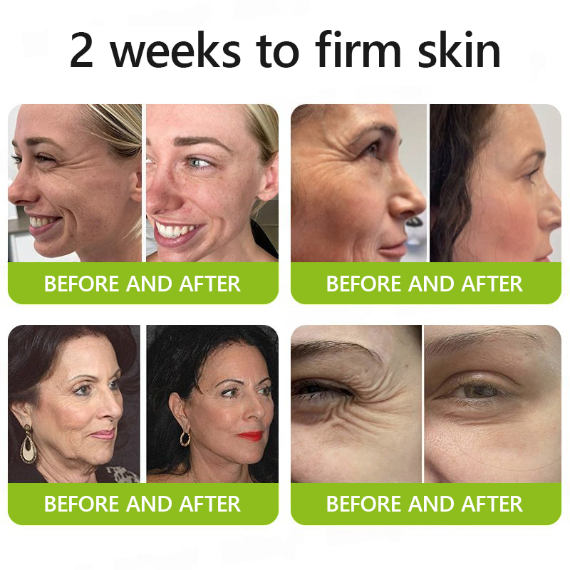 𝑶𝒇𝒇𝒊𝒄𝒊𝒂𝒍 𝑺𝒕𝒐𝒓𝒆😍| Regain youthful skin nown 💫STDEI® BOTOX & VITA A RETINOL SHOT Wrinkle Lift Tightening Cream