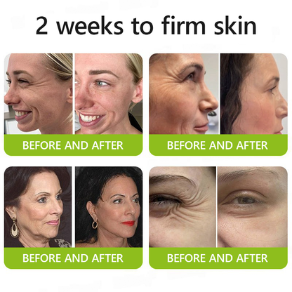 𝑶𝒇𝒇𝒊𝒄𝒊𝒂𝒍 𝑺𝒕𝒐𝒓𝒆😍| Regain youthful skin nown 💫STDEI® BOTOX & VITA A RETINOL SHOT Wrinkle Lift Tightening Cream