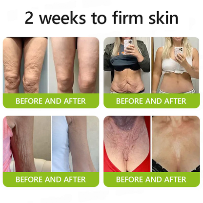 𝑶𝒇𝒇𝒊𝒄𝒊𝒂𝒍 𝑺𝒕𝒐𝒓𝒆😍| Regain youthful skin nown 💫STDEI® BOTOX & VITA A RETINOL SHOT Wrinkle Lift Tightening Cream