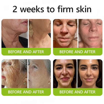 𝑶𝒇𝒇𝒊𝒄𝒊𝒂𝒍 𝑺𝒕𝒐𝒓𝒆😍| Regain youthful skin nown 💫STDEI® BOTOX & VITA A RETINOL SHOT Wrinkle Lift Tightening Cream