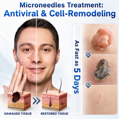 🏅👩🏻‍⚕️ 𝐎𝐟𝐟𝐢𝐜𝐢𝐚𝐥 𝐒𝐭𝐨𝐫𝐞 | 𝑵𝐞𝒌𝐢𝐬𝐬® 🌿 𝐁𝐨𝐭𝐚𝐧𝐢𝐜𝐚𝐥 𝐌𝐢𝐜𝐫𝐨𝐧𝐞𝐞𝐝𝐥𝐞 𝐇𝐲𝐝𝐫𝐨𝐜𝐨𝐥𝐥𝐨𝐢𝐝 𝐏𝐚𝐭𝐜𝐡 (𝐅𝐨𝐫 𝐒𝐤𝐢𝐧 𝐓𝐚𝐠𝐬, 𝐒𝐦𝐚𝐥𝐥 𝐒𝐤𝐢𝐧 𝐆𝐫𝐨𝐰𝐭𝐡𝐬, 𝐖𝐚𝐫𝐭𝐬, 𝐌𝐨𝐥𝐞𝐬, 𝐀𝐠𝐞 𝐒𝐩𝐨𝐭𝐬 & 𝐏𝐢𝐠𝐦𝐞𝐧𝐭𝐚𝐭𝐢𝐨𝐧 𝐂𝐨𝐧𝐜𝐞𝐫𝐧𝐬)
