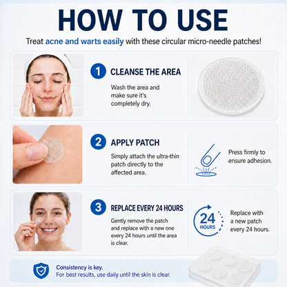 🏅👩🏻‍⚕️ 𝐎𝐟𝐟𝐢𝐜𝐢𝐚𝐥 𝐒𝐭𝐨𝐫𝐞 | 𝑵𝐞𝒌𝐢𝐬𝐬® 🌿 𝐁𝐨𝐭𝐚𝐧𝐢𝐜𝐚𝐥 𝐌𝐢𝐜𝐫𝐨𝐧𝐞𝐞𝐝𝐥𝐞 𝐇𝐲𝐝𝐫𝐨𝐜𝐨𝐥𝐥𝐨𝐢𝐝 𝐏𝐚𝐭𝐜𝐡 (𝐅𝐨𝐫 𝐒𝐤𝐢𝐧 𝐓𝐚𝐠𝐬, 𝐒𝐦𝐚𝐥𝐥 𝐒𝐤𝐢𝐧 𝐆𝐫𝐨𝐰𝐭𝐡𝐬, 𝐖𝐚𝐫𝐭𝐬, 𝐌𝐨𝐥𝐞𝐬, 𝐀𝐠𝐞 𝐒𝐩𝐨𝐭𝐬 & 𝐏𝐢𝐠𝐦𝐞𝐧𝐭𝐚𝐭𝐢𝐨𝐧 𝐂𝐨𝐧𝐜𝐞𝐫𝐧𝐬)